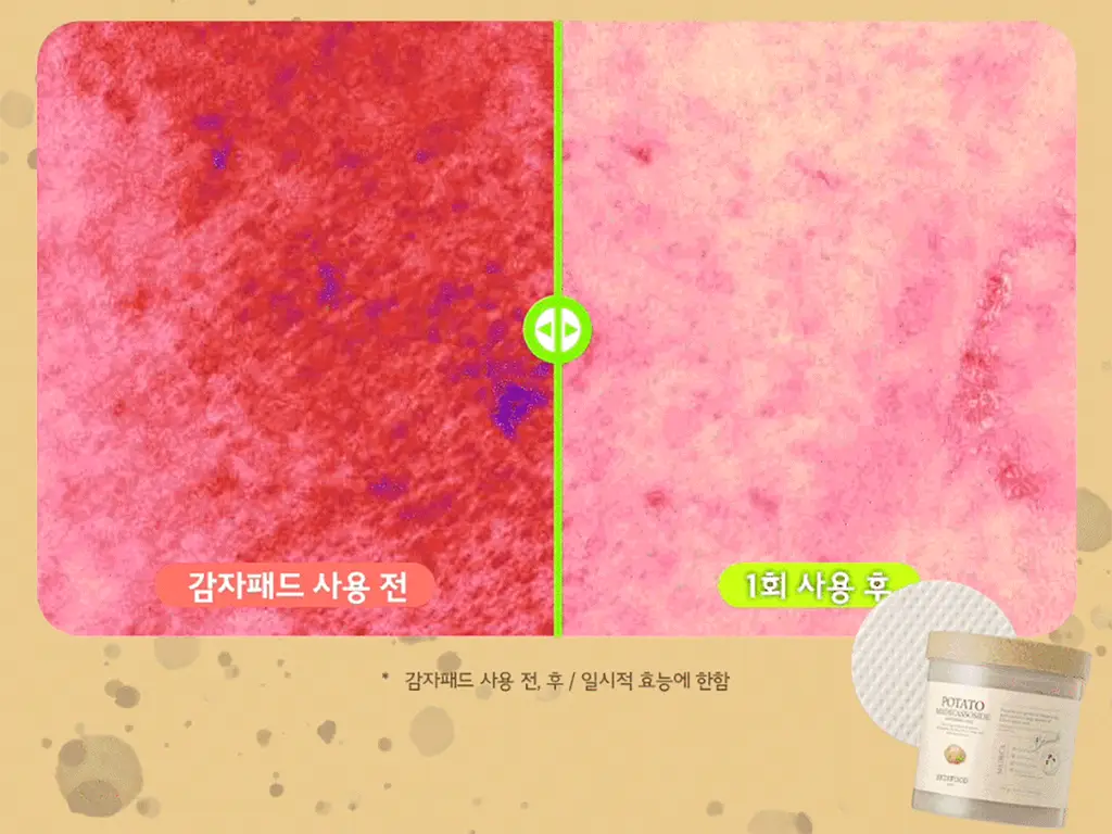 [열감진정] 스킨푸드 감자 마데카소사이드 수딩 패드 60매 상세페이지 6